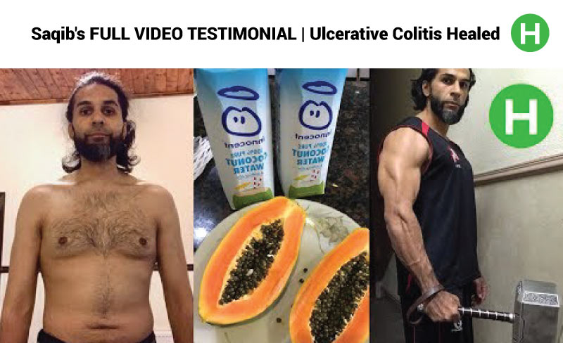 Saqib's FULL VIDEO TESTIMONIAL | Ulcerative Colitis Healed