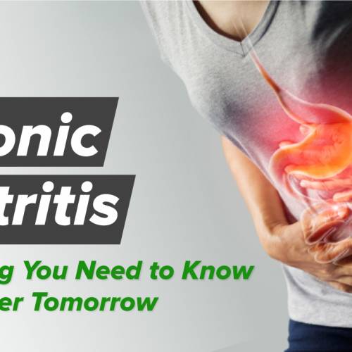 Chronic Gastritis : What Is It, Causes, Symptoms, Diagnosis, and More