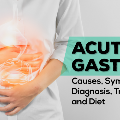 Acute Gastritis: Causes, Symptoms, Diagnosis, Treatment and Diet