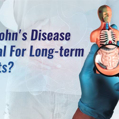 Can Crohn’s Disease be Fatal for Long-term Patients?
