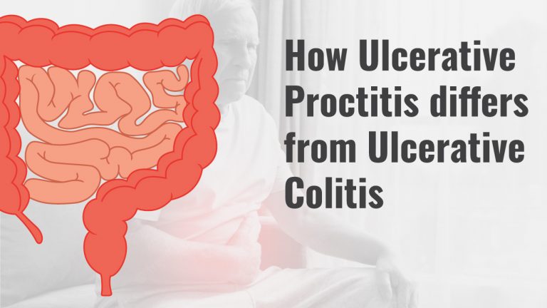 Ulcerative Proctitis Vs. Colitis: Causes, Symptoms, Treatment | HighCarbHealth